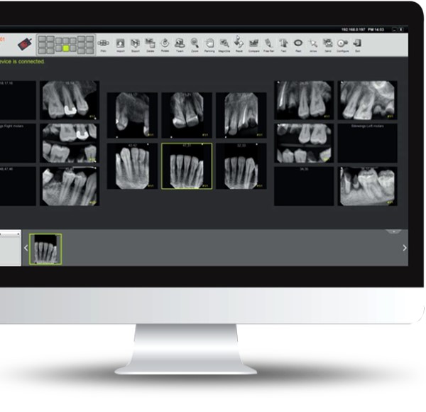 Genoray GIX-1 Dental Digital X-Ray Imaging Sensors