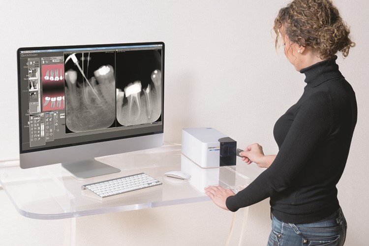 Owandy-CR2 Phosphor Plate Dental Digital X-Ray System