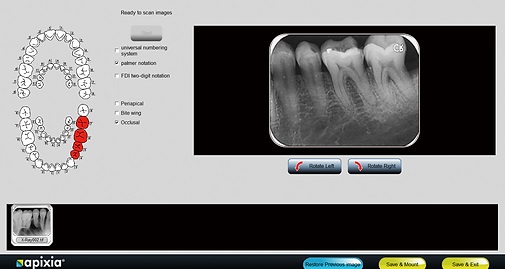 Apixia EXL Dental Phosphor Plate Software